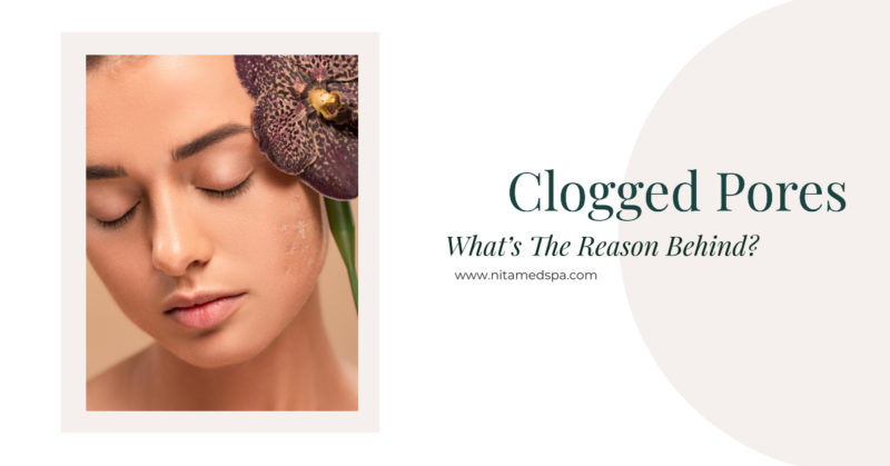 Clogged Pores Common Causes And Cure Nita Med Spa