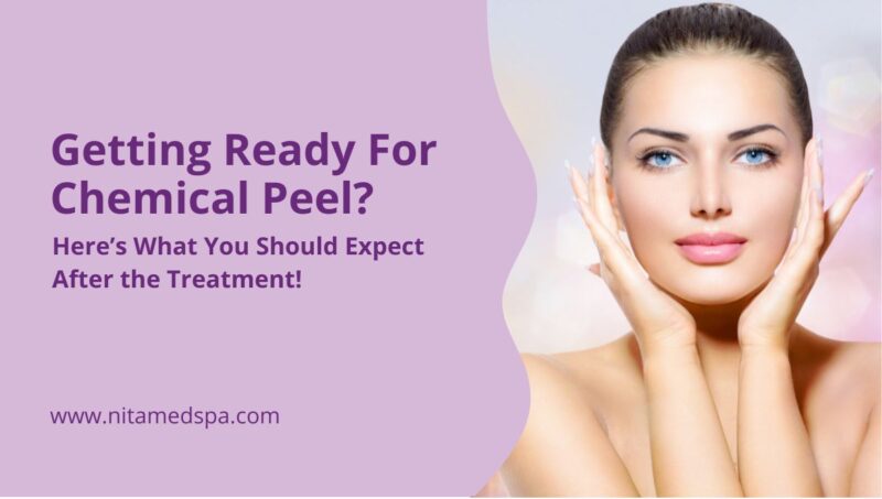 Getting Ready For A Chemical Peel Heres What You Should Expect After The Treatment Nita Med Spa